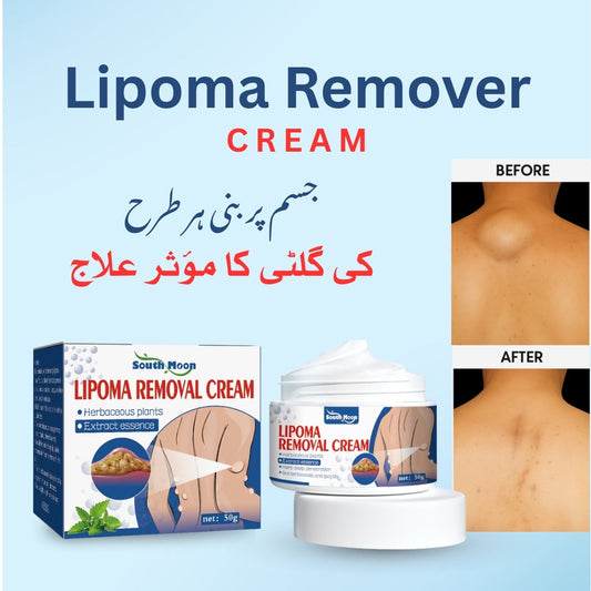 South Moon Lipoma Removal Cream(Buy 1get 1free)